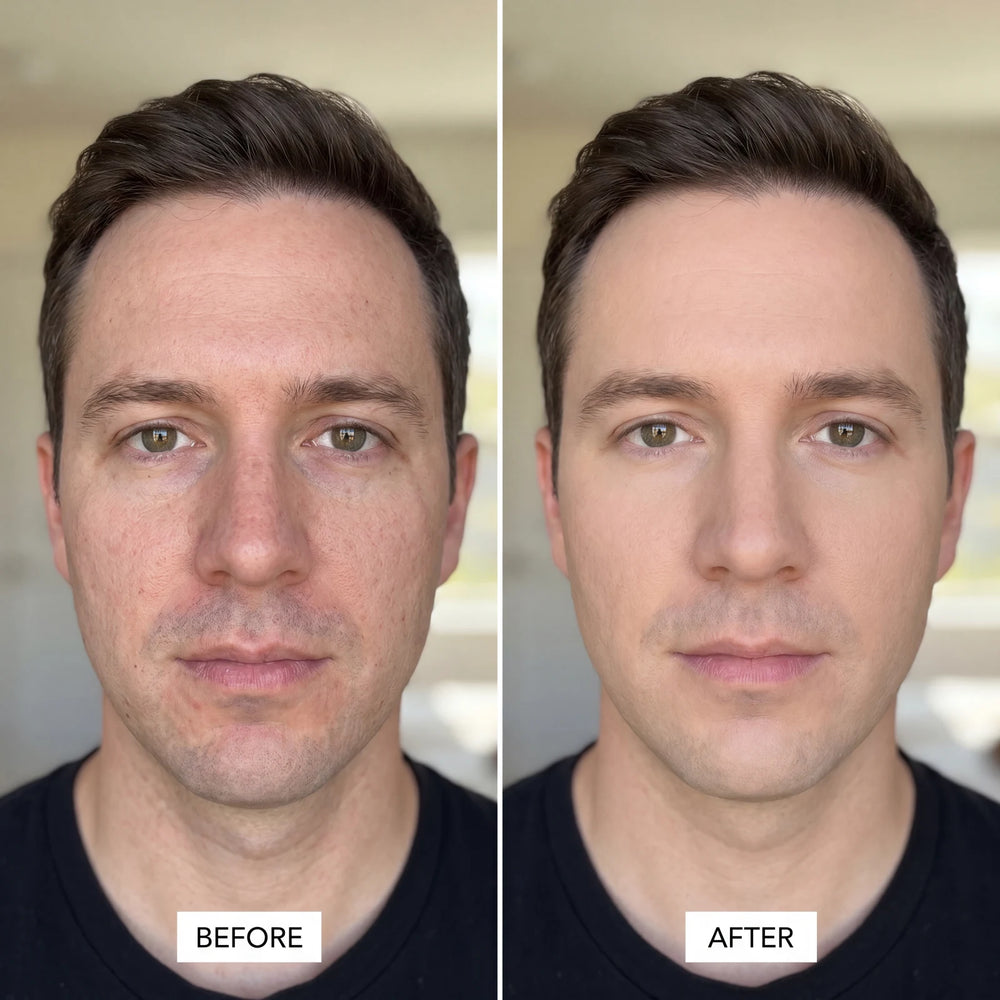 Niacinamide Serum for Men — Smaller Pores, Even Tone in use