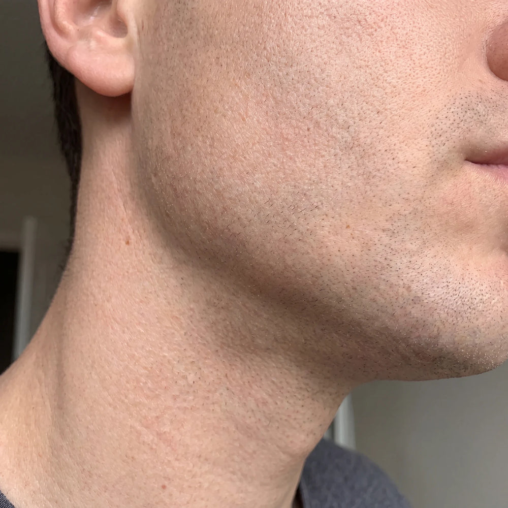 Aftershave Balm for Men — Stop Razor Burn Instantly in use
