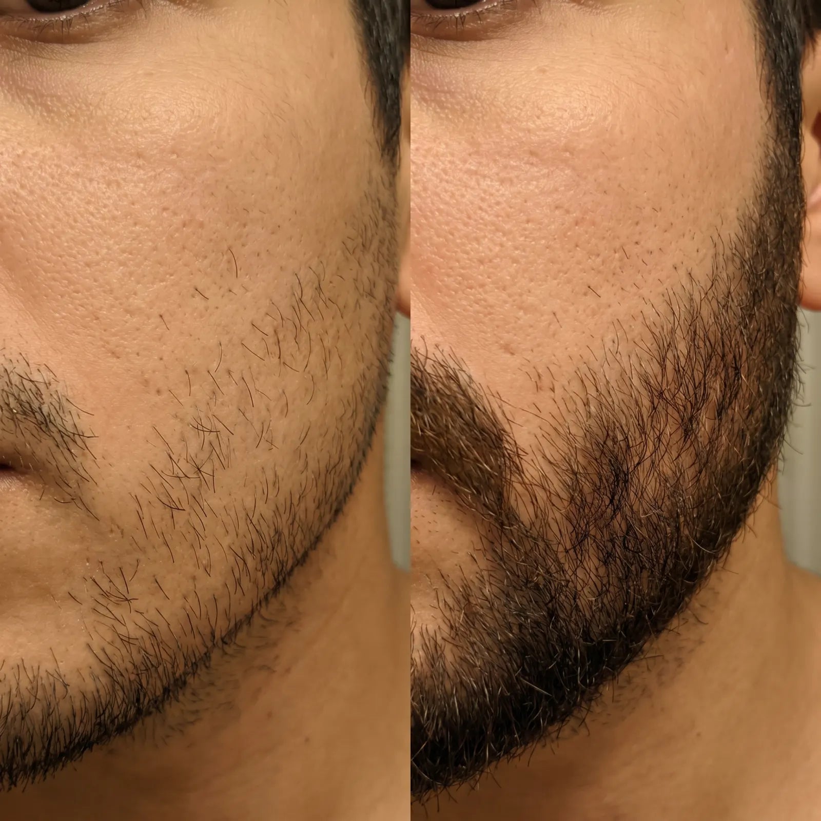 STUBBL before and after patchy beard result — The Sharper Man